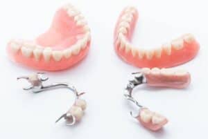 Dentures vs. Partials: A Comprehensive Guide to Choosing the Right Denture Solution