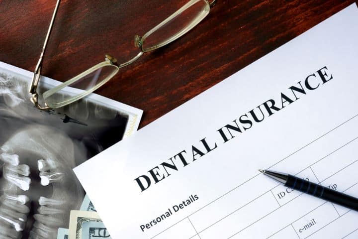 Dental insurance retainer