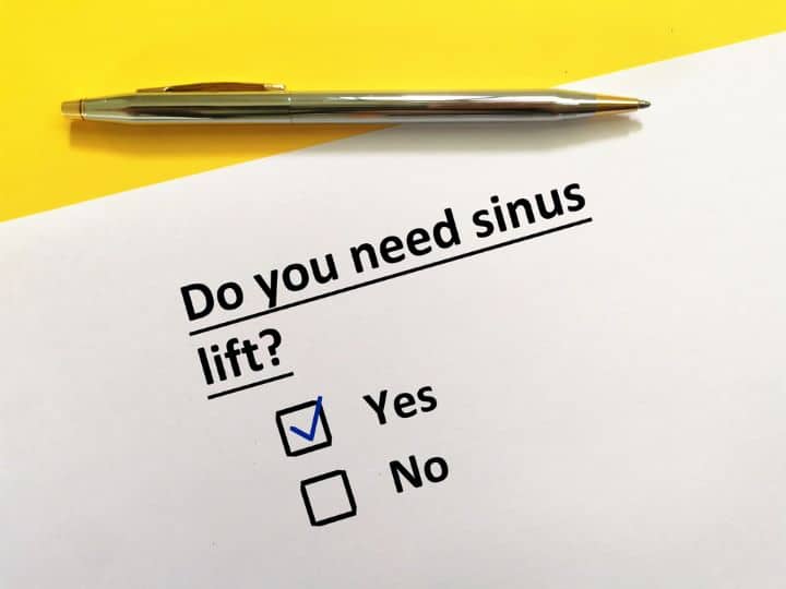 Eligibility for Sinus Lift:
