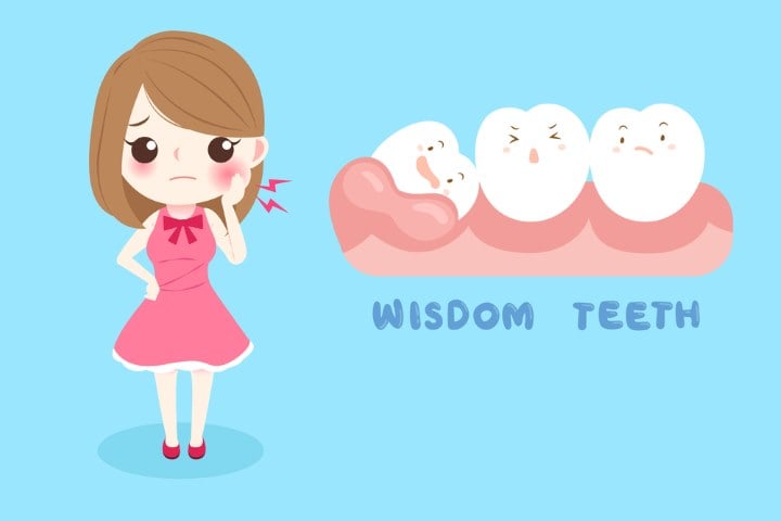 Wisdom Teeth Age